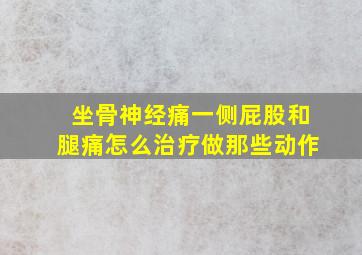 坐骨神经痛一侧屁股和腿痛怎么治疗做那些动作