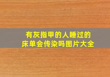 有灰指甲的人睡过的床单会传染吗图片大全