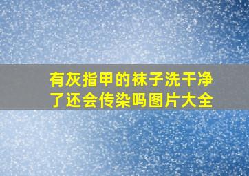 有灰指甲的袜子洗干净了还会传染吗图片大全