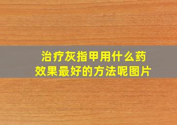 治疗灰指甲用什么药效果最好的方法呢图片