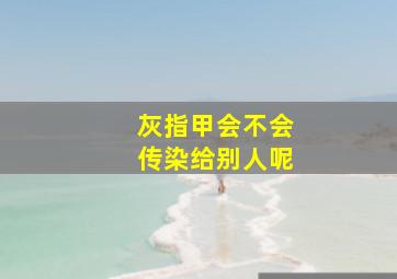 灰指甲会不会传染给别人呢