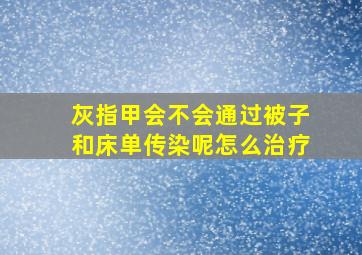 灰指甲会不会通过被子和床单传染呢怎么治疗