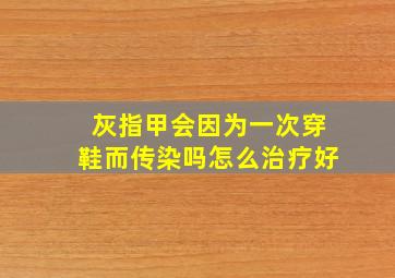 灰指甲会因为一次穿鞋而传染吗怎么治疗好