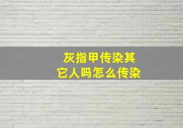 灰指甲传染其它人吗怎么传染