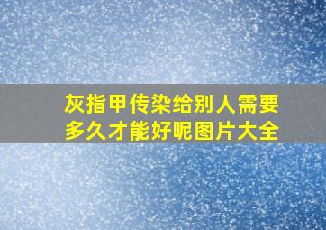 灰指甲传染给别人需要多久才能好呢图片大全