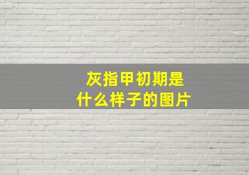 灰指甲初期是什么样子的图片