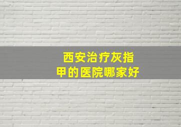 西安治疗灰指甲的医院哪家好